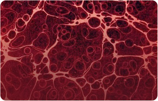 Bacillus Coagulans