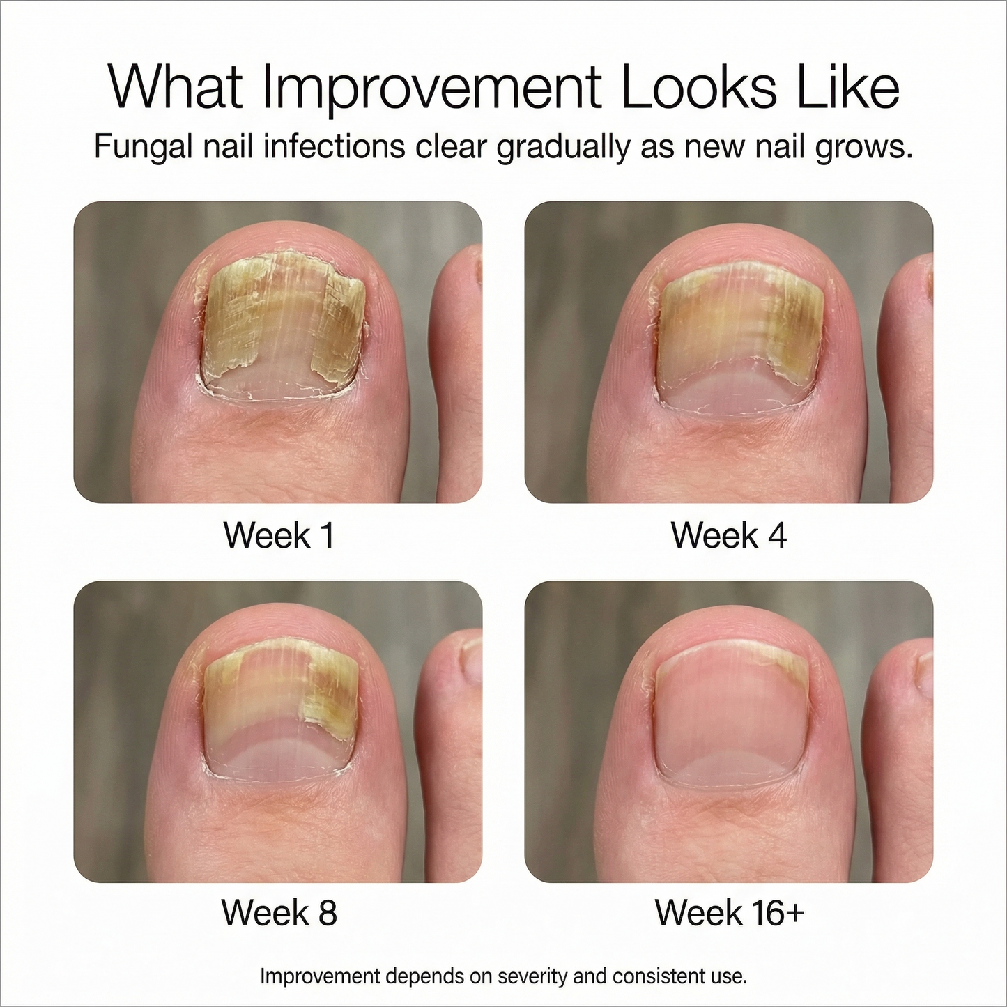 FungusLab™ nail treatment