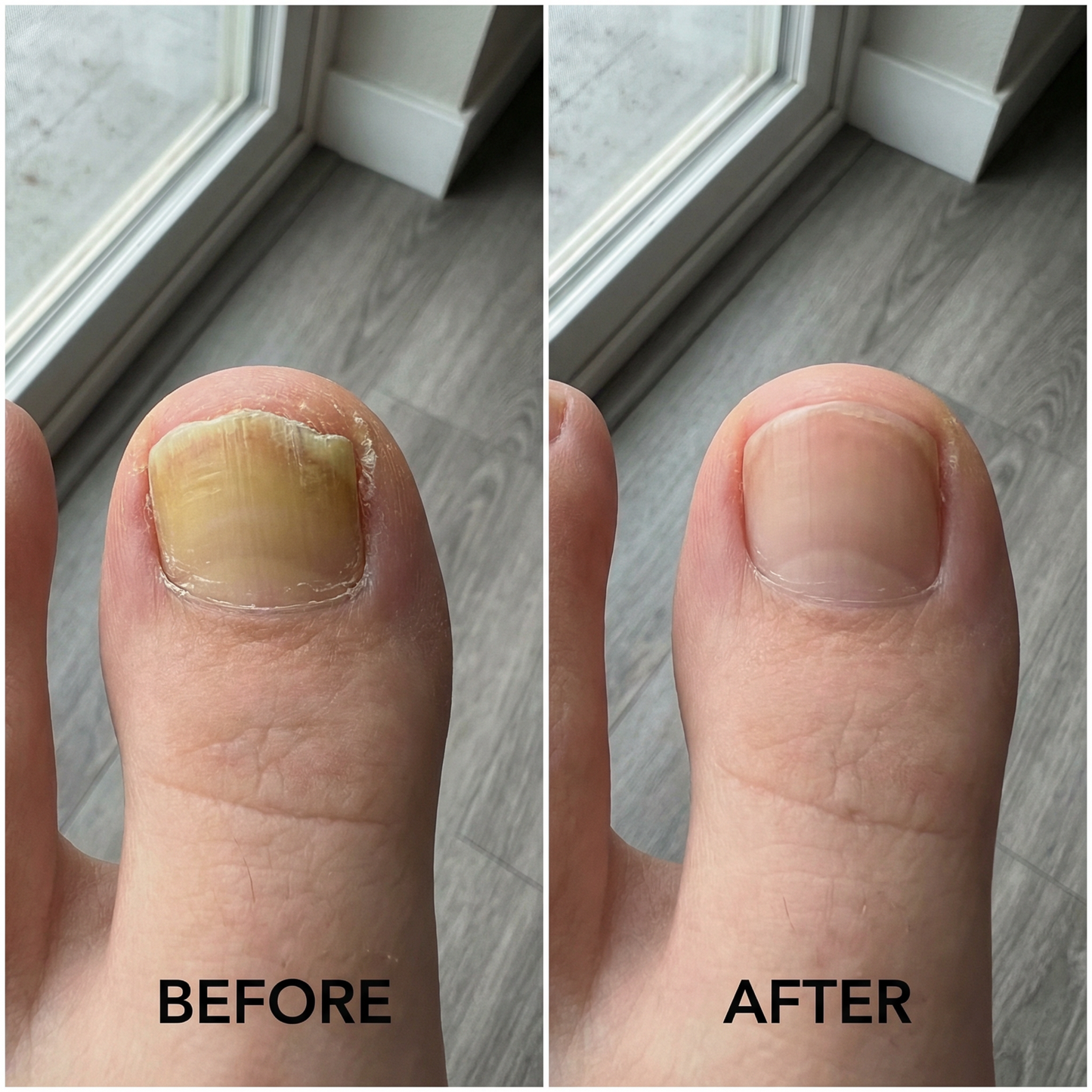FungusLab™ nail treatment