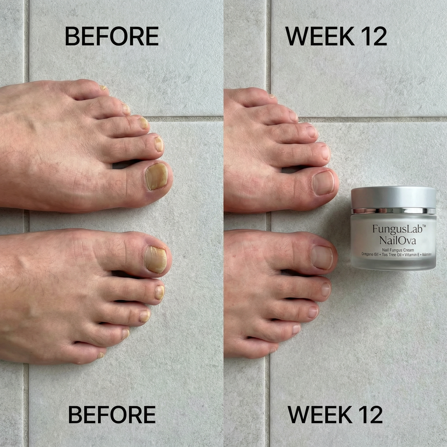 FungusLab™ nail treatment